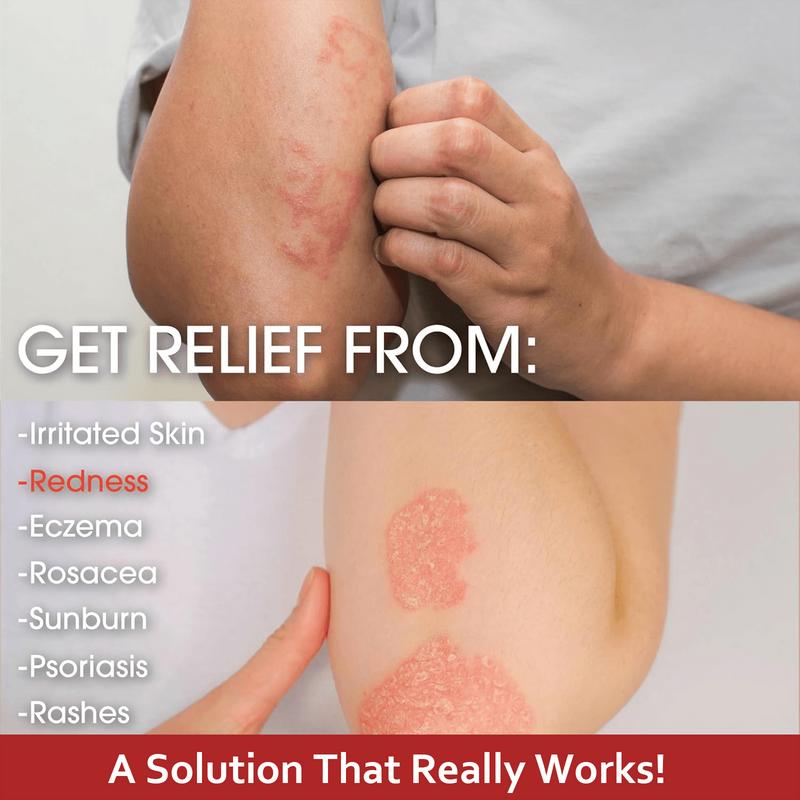 Herbal Moisturizing Cream for Dry & Sensitive Skin