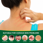 Herbal Moisturizing Cream for Dry & Sensitive Skin